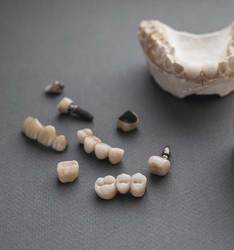 restorative dentistry crowns and implants illustration